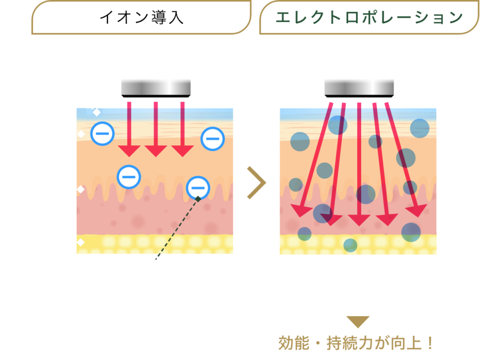 イオン導入とe-cool（エレクトロポレーション）の違い