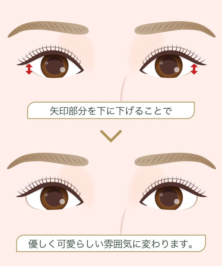 グラマラスライン形成とは