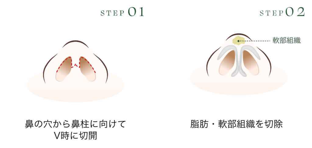 オープン法
