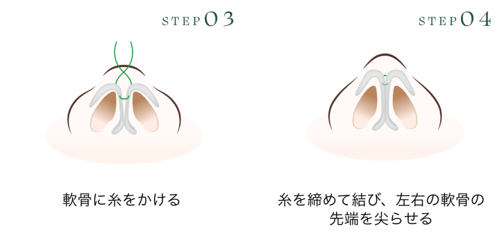 オープン法