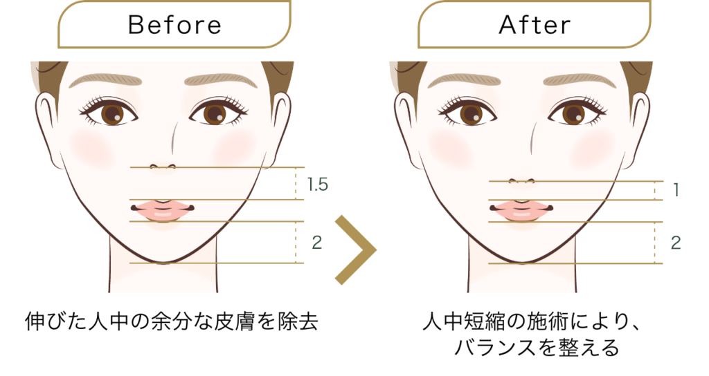 人中短縮に大切なのはバランス