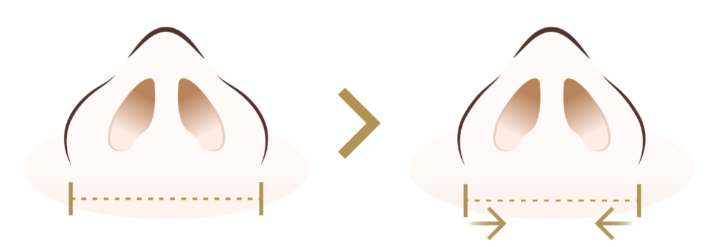外側法