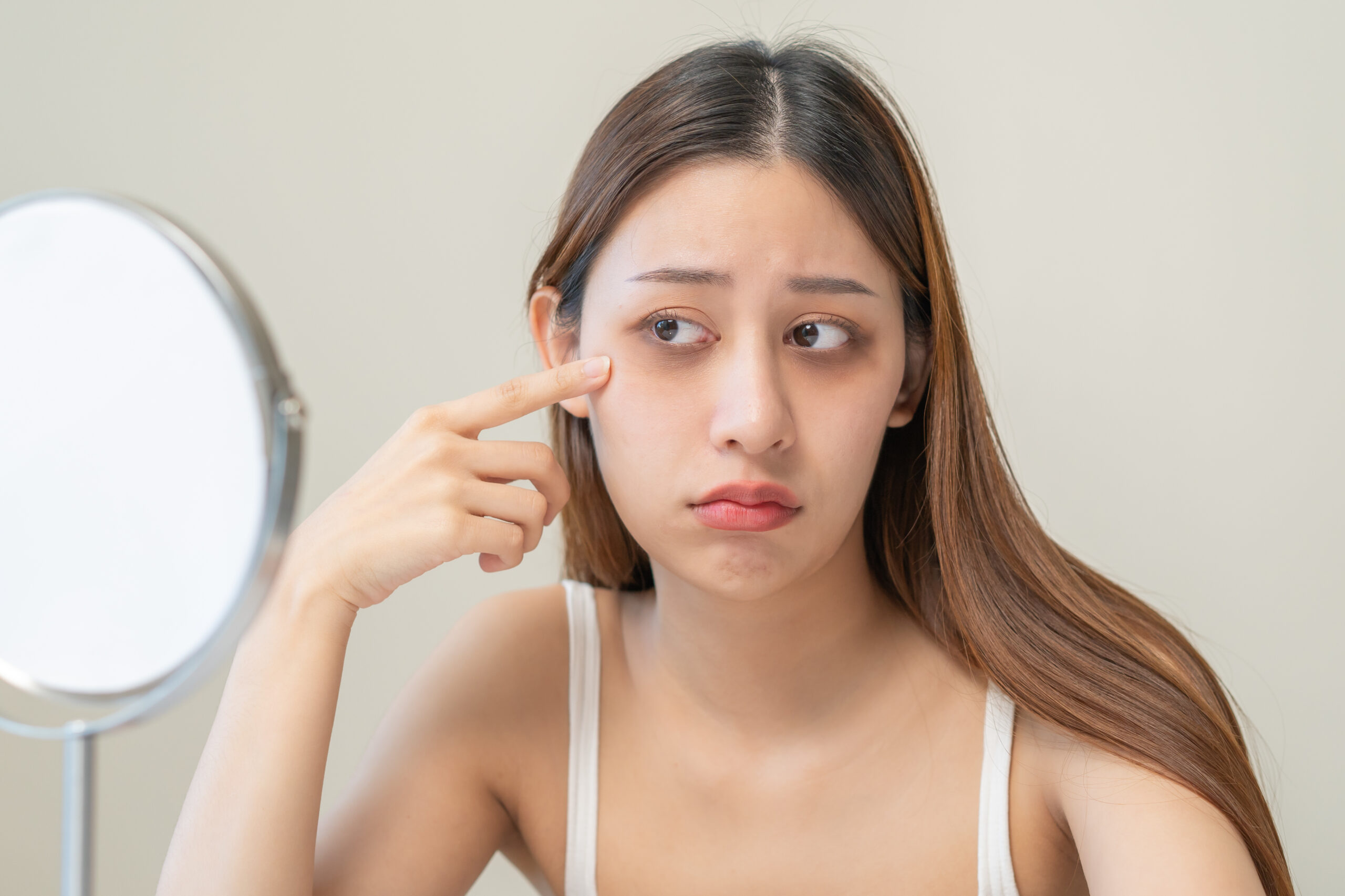 若い人の黒クマはなぜ起きる?|原因とおすすめの治療法まとめ