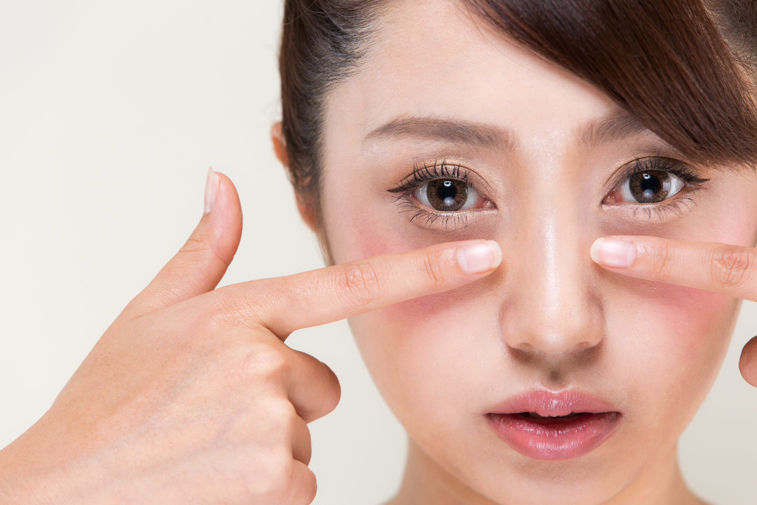 若いのに目の下のくぼみはなぜ?原因と改善方法を医師が解説