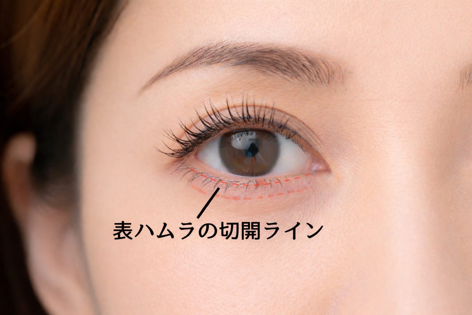 表ハムラとは何?効果・向いている人・裏ハムラとの違いを解説
