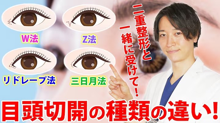 二重整形を受けるならどのデザインがオススメ? 目頭切開の種類やそれぞれの違いを徹底比較!